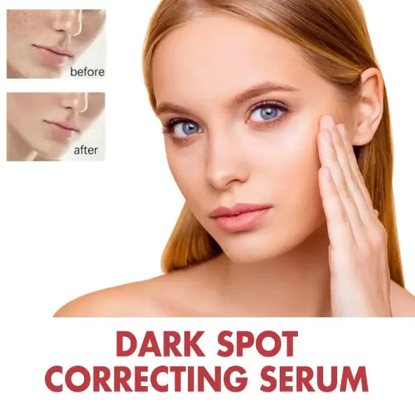 Niacinamide 10% Dark Spot Correcting Serum
