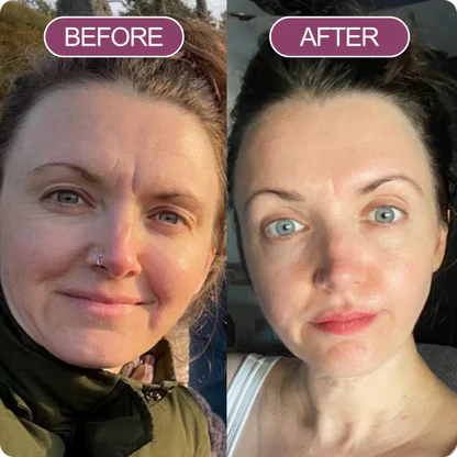 Dr. Melaxin™ Cemenrete Calcium Eye Lift Duo