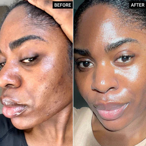 Dr. Melaxin™ Cemenrete Calcium Eye Lift Duo