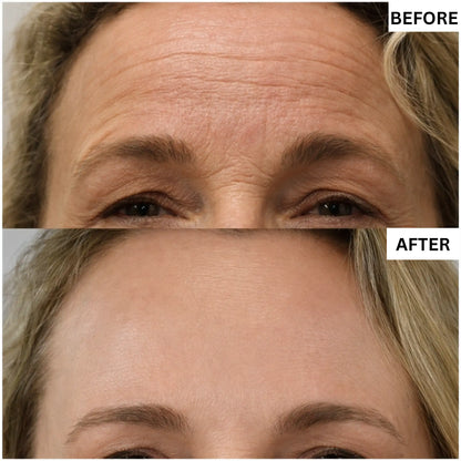 Dr Melaxin Premium Skincare Set (5 pcs)™