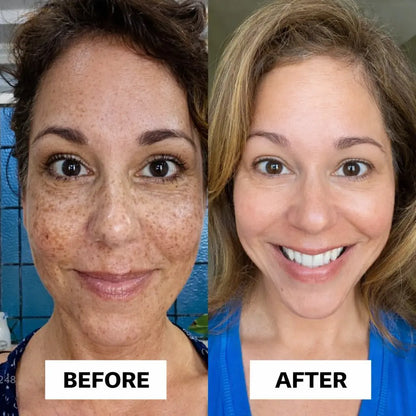 Dr Melaxin Premium Skincare Set (5 pcs)™