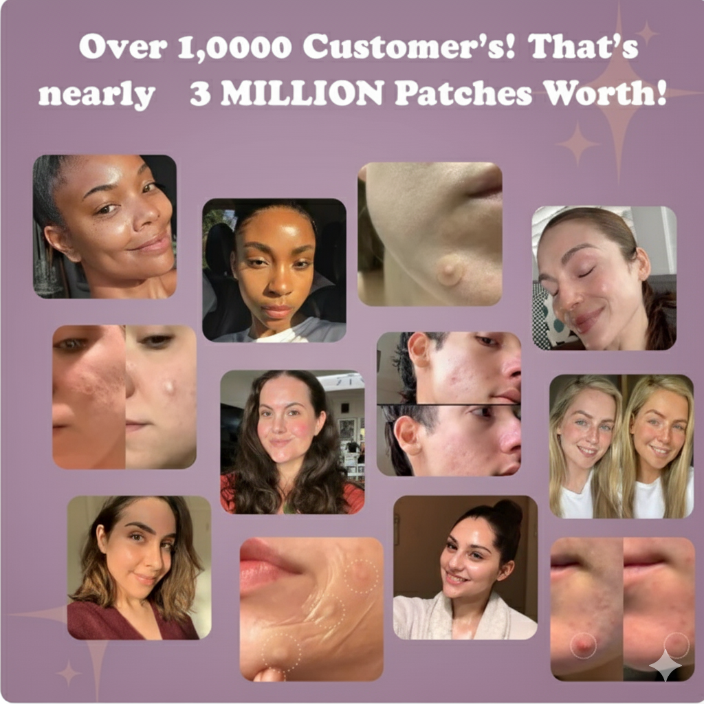 Hydrocolloid Acne Roll™