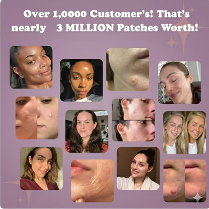 Hydrocolloid Acne Roll™