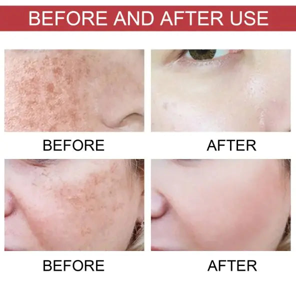 Niacinamide 10% Dark Spot Correcting Serum