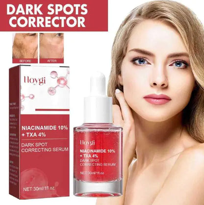 Niacinamide 10% Dark Spot Correcting Serum